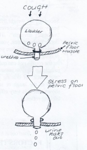 incontinence drawing